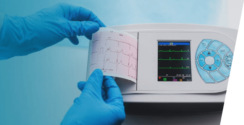 Stay Heart Smart: The Benefits of ECG Services at Home