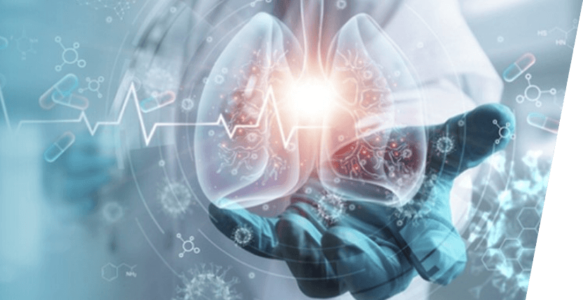  Everything you need to know about Pneumonia