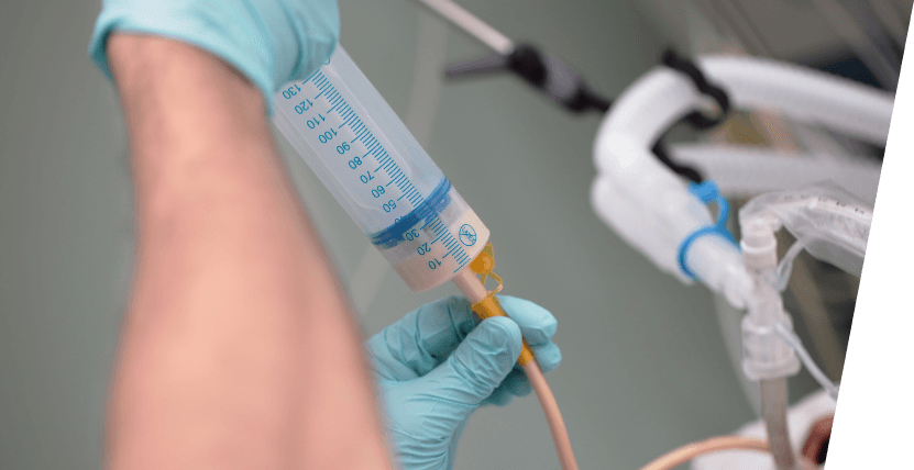 The Essential Guide to Nursing Ryle’s tube Feed and At-Home Care