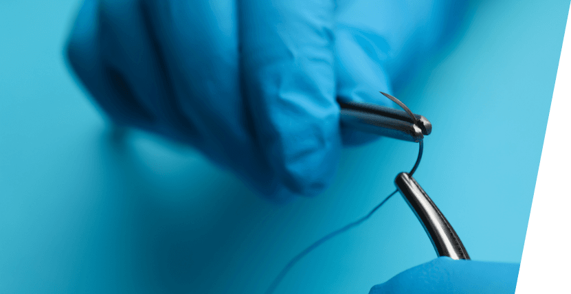  Ensuring Successful Suture Removal with Professional Home Care Services