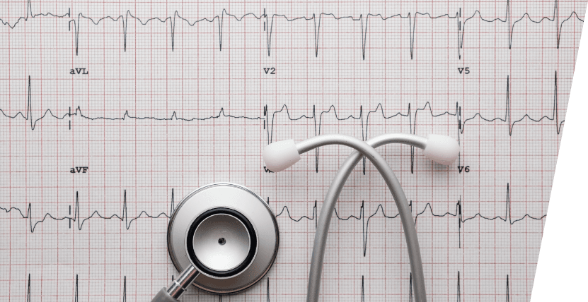 Understanding ECG and the Benefits of Getting an ECG at Home